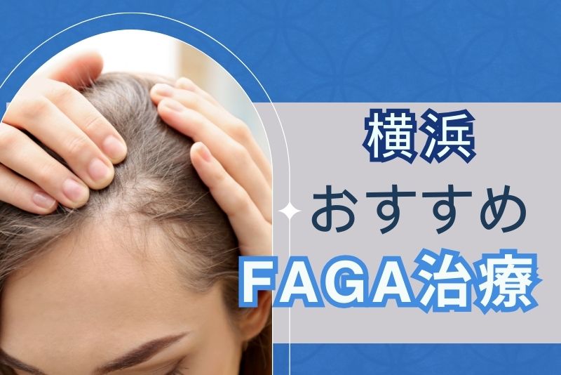 横浜でおすすめのFAGA治療クリニック